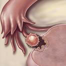 Fetal Growth wk1