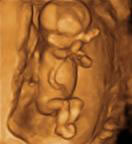 Gestation 13-16 Weeks