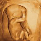 Gestation 13-16 Weeks