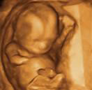 Gestation 13-16 Weeks