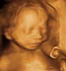 Gestation 21-24 Weeks