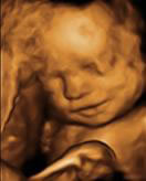 Gestation 25-28 Weeks