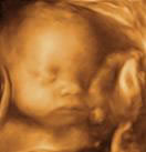 Gestation 29-32 Weeks