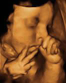 Gestation 33-36 Weeks