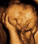 Gestation 37-40 Weeks