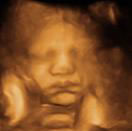 Gestation 37-40 Weeks