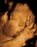 Gestation 37-40 Weeks