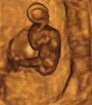 Gestation 7th Week