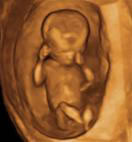 Gestation 8-12 Weeks